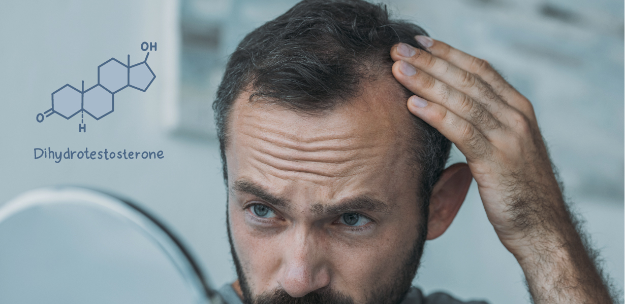 Hormonal Hair Loss: Causes & Recovery