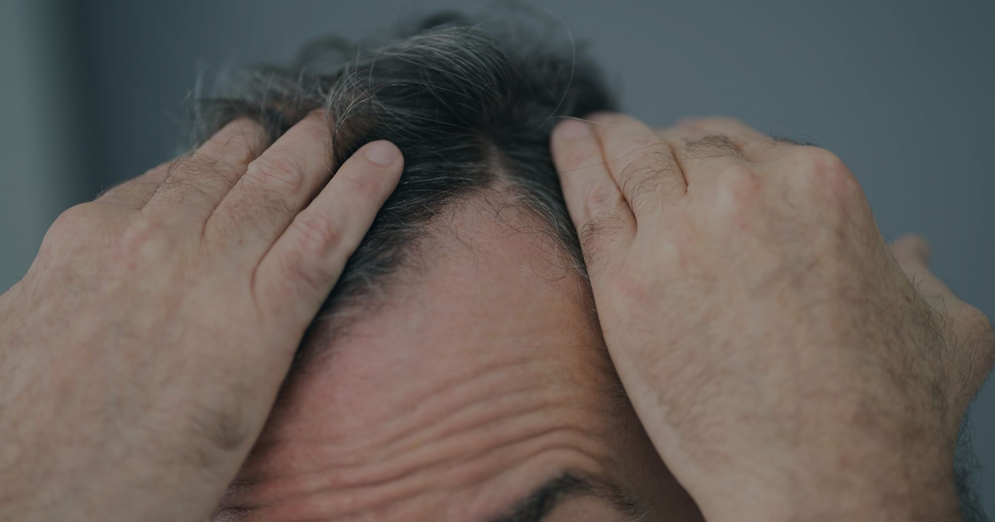 Hair Loss Symptoms & Causes